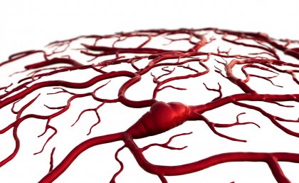 Stroke claims six million lives worldwide each year Stroke claims six million lives worldwide each year